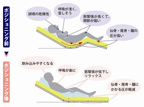 リハビリテーション課 News 医療法人社団 誠広会 平野総合病院