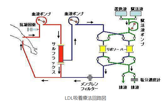 ＬＤＬ吸着療法回路図