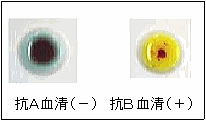 症例3
